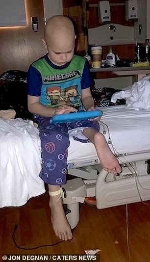O menino após a cirurgia (Foto: Reprodução/Daily Mail)