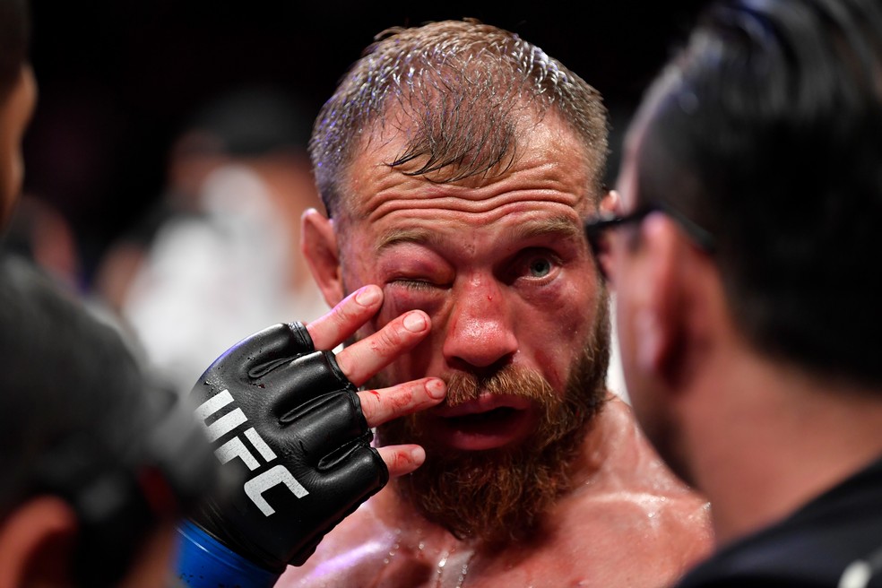 Olho direito de Cerrone: americano deixou o octÃ³gono e foi para o hospital â?? Foto: Getty Images