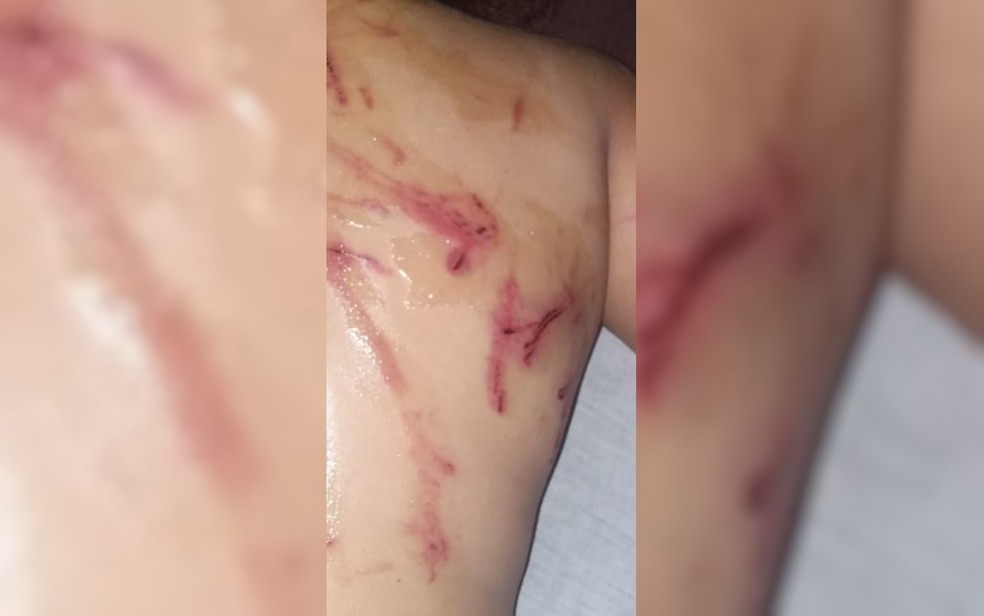 Menina é agredida com cipós em Trindade Goiás — Foto: Divulgação/Polícia Militar