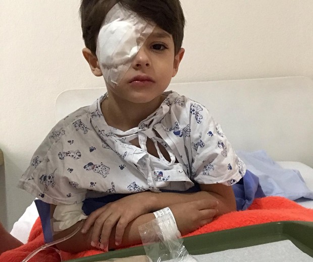 Bento, de 5 anos, teve queimadura na córnea após acidente com álcool gel (Foto: Reprodução/Facebook/Camila Mendes)