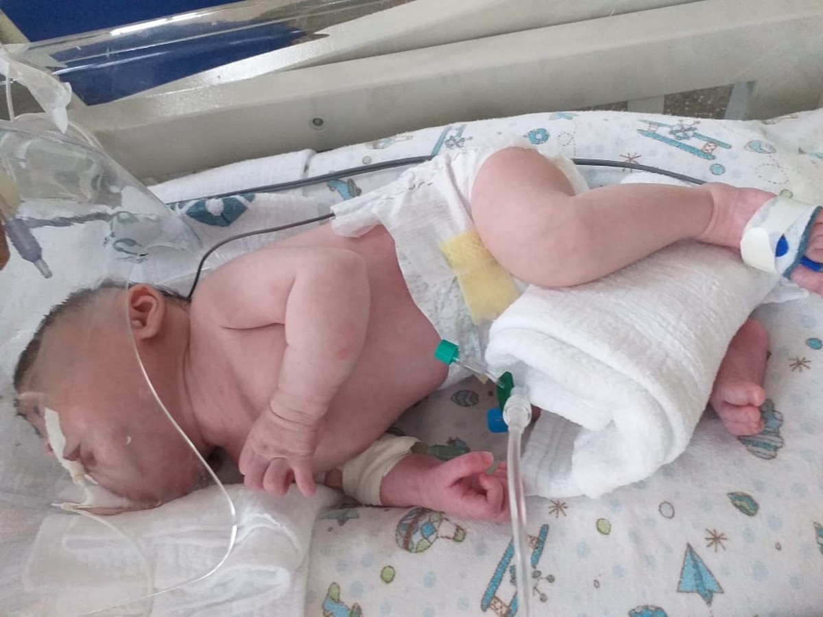 Após entrar na Justiça, mãe consegue cirurgia para bebê que nasceu com malformação em MT Mato