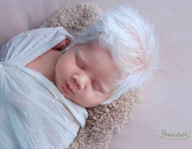 Bebê albino com cabelos platinados (Foto: Arquivo pessoal)