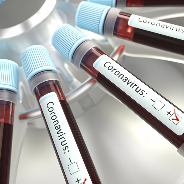 Coronaviruses research, conceptual illustration. Vials of blood in a centrifuge being tested for coronavirus infection. (Foto: Getty Images/Science Photo Libra)