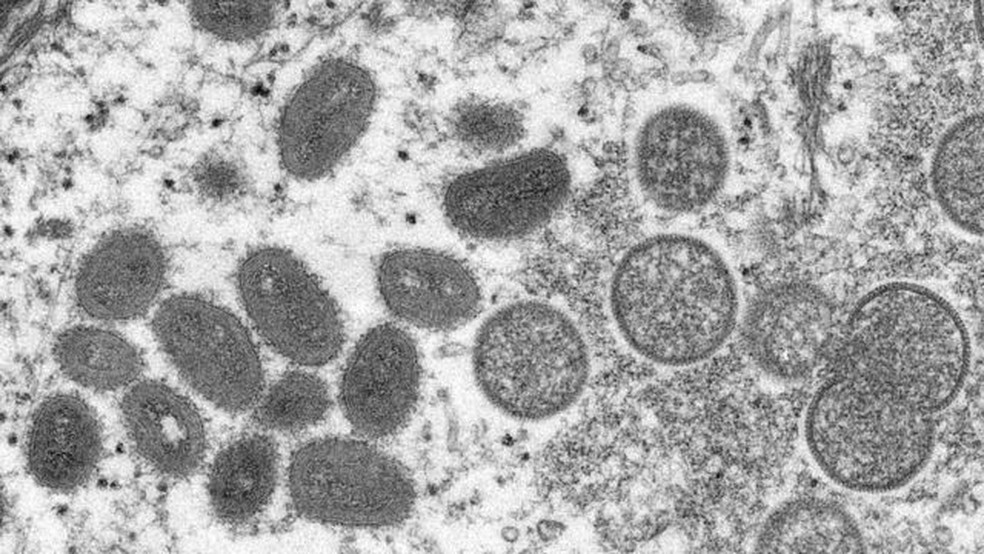 O monkeypox visto em microscópio eletrônico — Foto: CDC/REUTERS