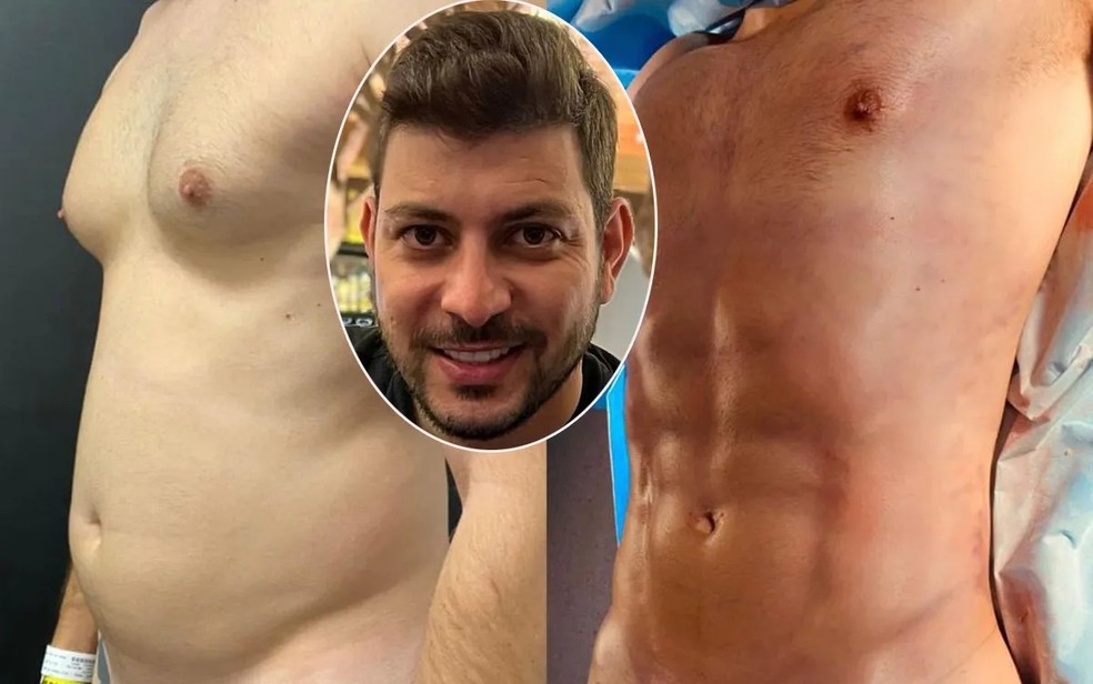 O antes e depois do ex-BBB Caio Afiune — Foto: Divulgação