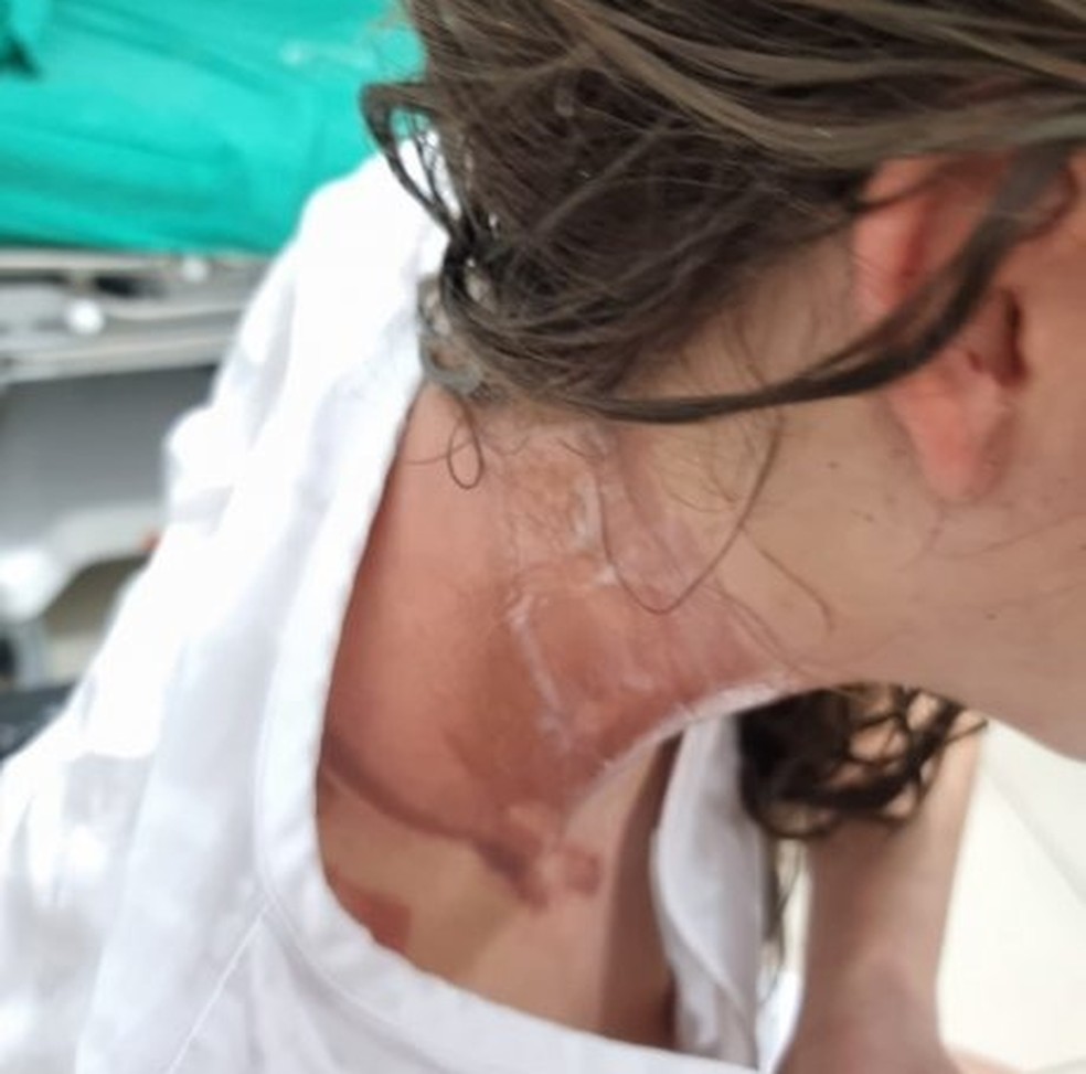 Estudantes da UFPR de Palotina são feridos em trote com creolina — Foto: Correio do Ar