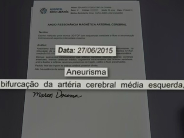 Aneurisma foi diagnosticado em 2015 (Foto: Reprodução / Jornal Nacional)