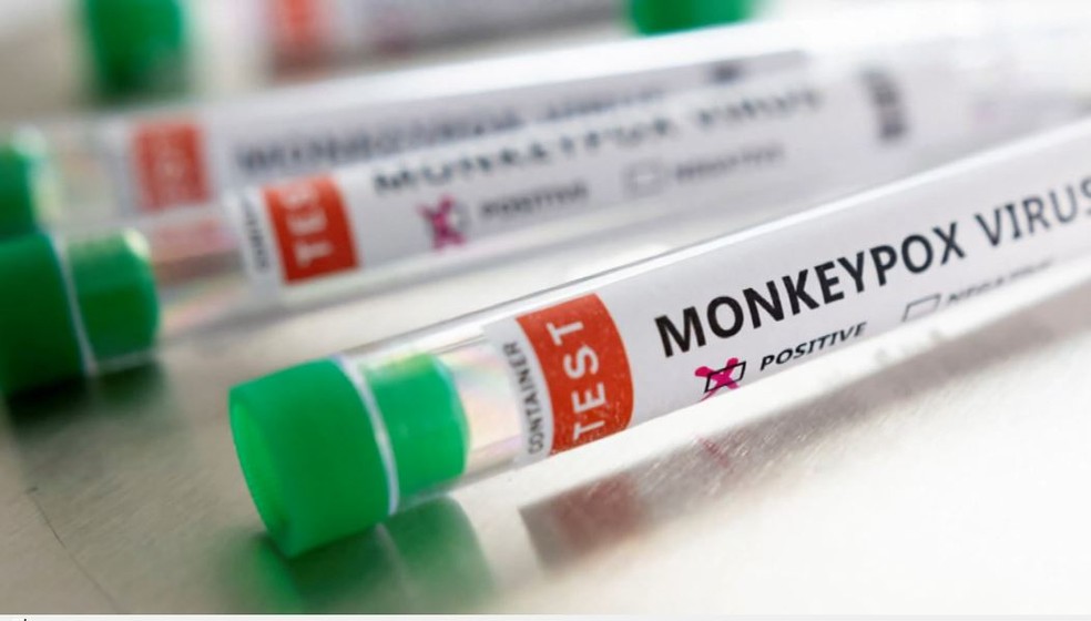 Teste positivo de varíola dos macacos — Foto: Reprodução/EPTV