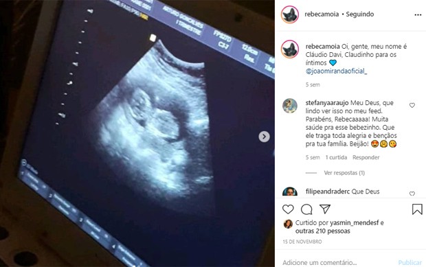 Rebeca Moia, filha de Ximbinha, mostra ultrassom de sua gravidez (Foto: Reprodução/Instagram)