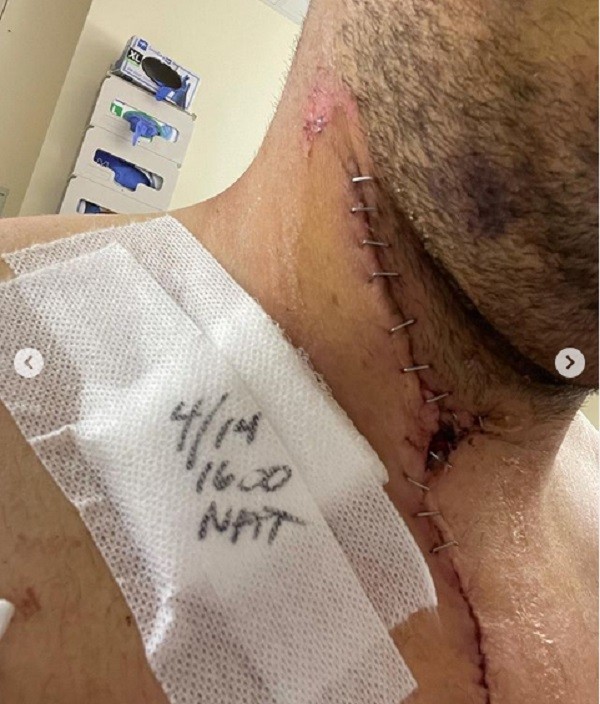 Scott DeShields Jr. quando ainda estava internado, se recuperando da explosão do rifle (Foto: Instagram)