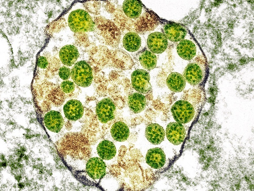 Imagem de célula infectada pelo coronavírus Sars-Cov-2  — Foto: Cynthia Goldsmith e Azaibi Tamin/CDC