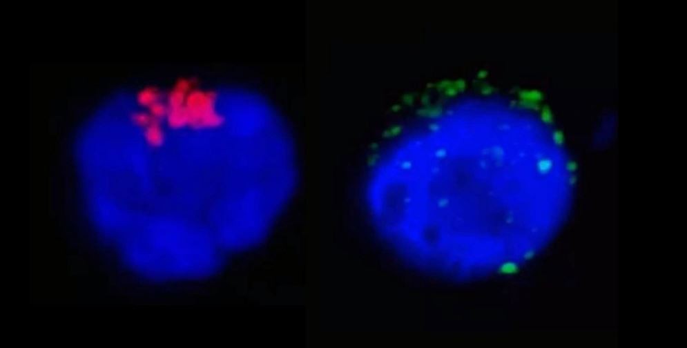 Na imagem da esquerda é possível observar a enzima RdRp do SARS-CoV-2 (em vermelho), que regula a replicação viral, no interior do linfócito T CD4.Na imagem da direita, as manchas verdes representam as proteínas de espícula do SARS-CoV-2 (spike proteins) próximas à membrana da célula de defesa humana (Foto: Unicamp/Divulgação)