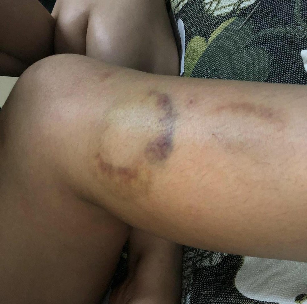 Ana Clara de Souza Arante, de 23 anos,  vítima de violência doméstica — Foto: arquivo pessoal