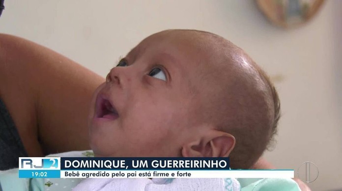 Bebe Espancado Pelo Pai Em Sao Fidelis Rj Recebe Alta Apos Dois Meses Internado Vamos Dar O Amor Que Ele Nao Teve Diz Tia Norte Fluminense G1