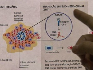 Pesquisa identificou gene responsável por metástase de tumores (Foto: Antonio Luiz/EPTV)