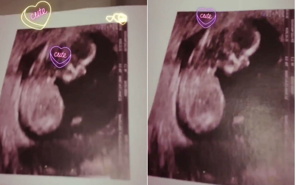 Claudia Leitte postou ultrassom da filha. — Foto: Reprodução/Instagram 