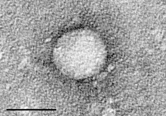 Micrografia eletrônica do vírus da hepatite C (Foto: Center for the Study of Hepatitis C /The Rockefeller University)