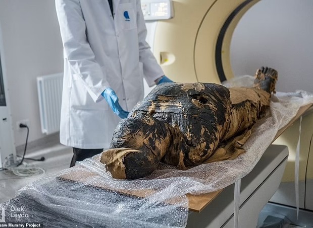 Múmia grávida  (Foto: Reprodução Daily Mail/ Warsaw Mummy Project )