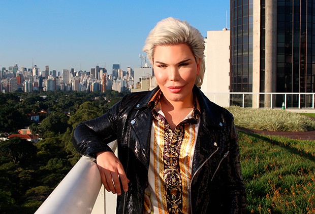 Rodrigo Alves sobre suas 72 cirurgias plásticas: “Sei que exagerei, mas fiz  porque precisei” - Quem