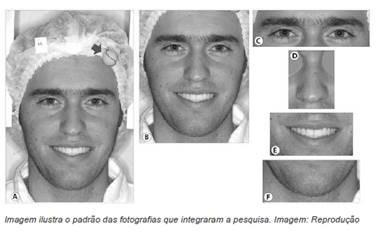 Pesquisa sobre sorriso da Universidade de Brasília (Foto: Divulgação)