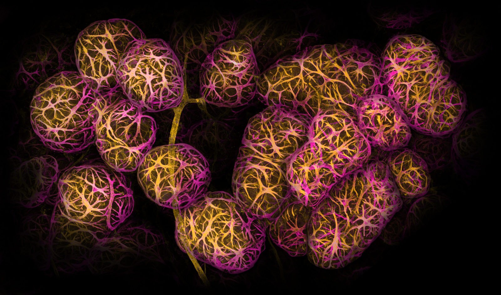 Tecido mamário mostrando células mioepiteliais (Foto: Reprodução/Caleb Dawson)