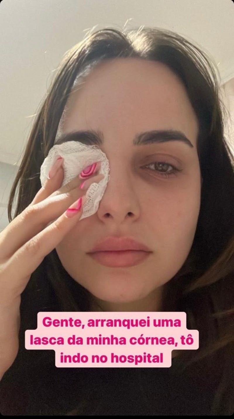 Influencer Jéssica Cardoso arranca lasca da córnea por conta das unhas grandes (Foto: Reprodução/Instagram)