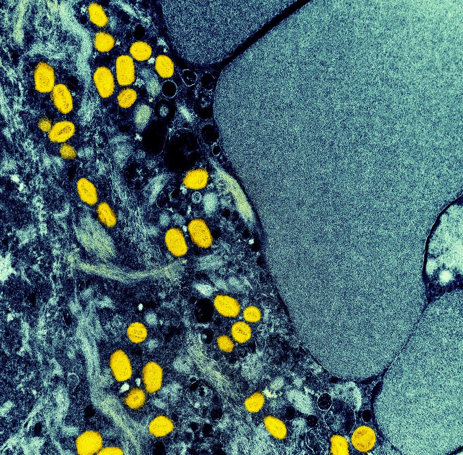 Partículas do vírus da varíola dos macacos (amarelo) encontradas dentro do tecido de uma célula infectada (azul),