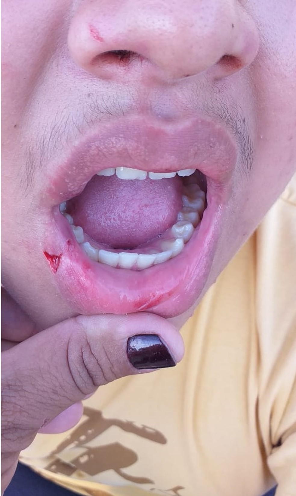Garoto teria sido agredido por funcionário de empresa de transporte. — Foto: Divulgação