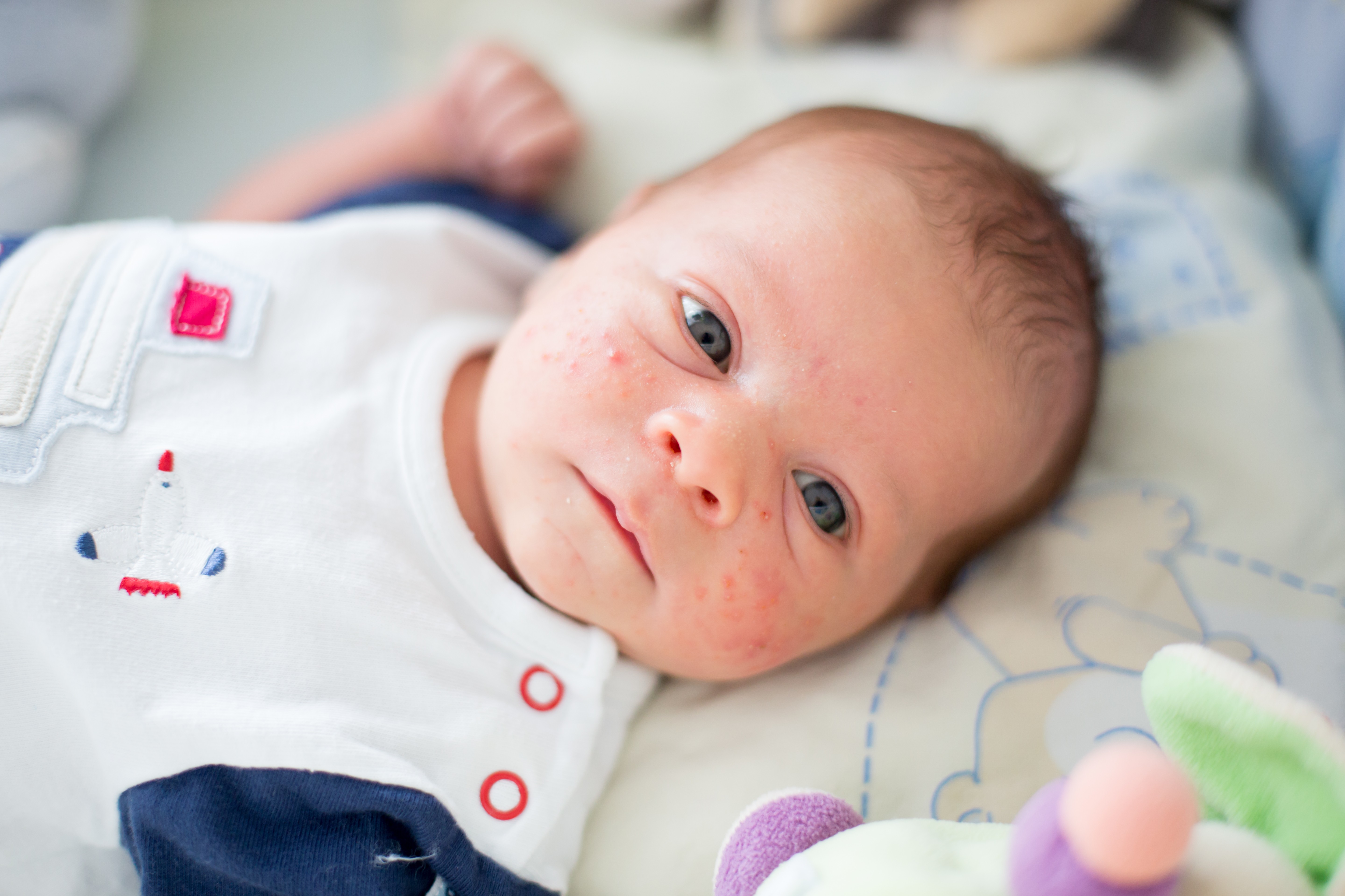 Brotoejas no bebê aparecem no verão, mas, no inverno, surgem por conta do excesso de roupas (Foto: Getty Images)