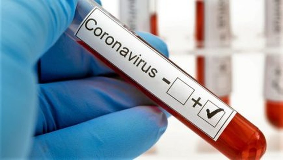Exame de coronavírus — Foto: Divulgação