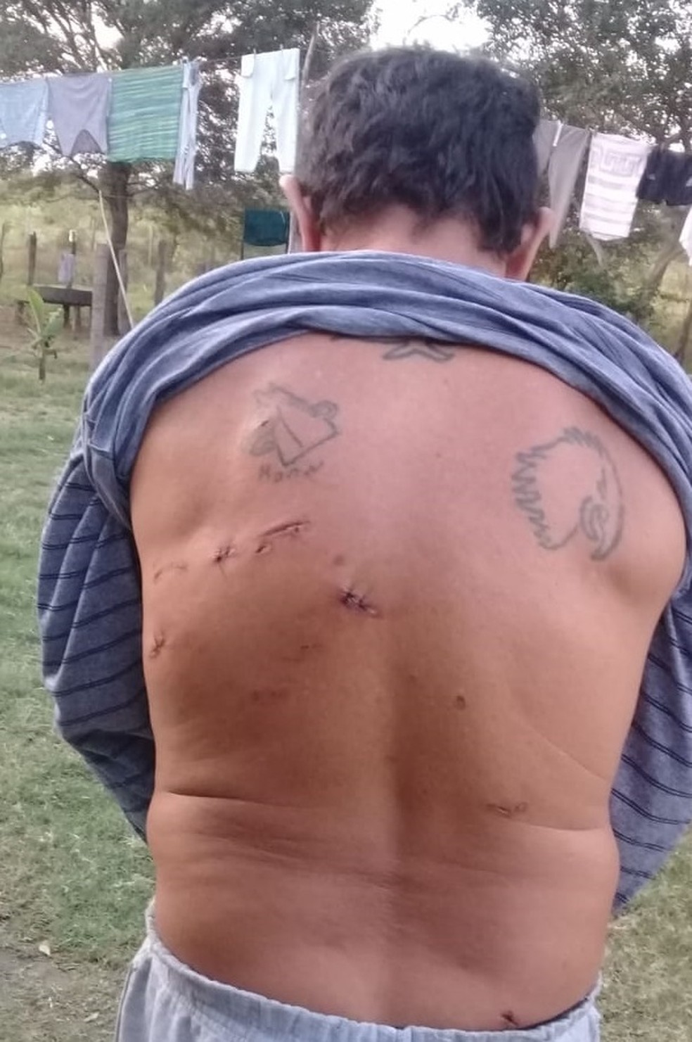 Julian se recupera após ser atacado por onça-pinta em fazenda de Porto Murtinho.  Foto: Anselma Benitez/Reprodução