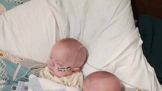 Após passar 150 dias no hospital, gêmeos que nasceram com 24 semanas vão para casa