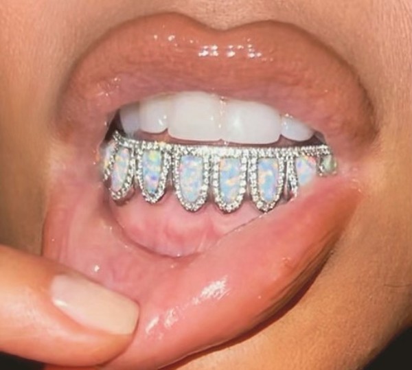 A foto compartilhada pela socialite Kim Kardashian ostentando seus grillz de opala e diamantes (Foto: Instagram)