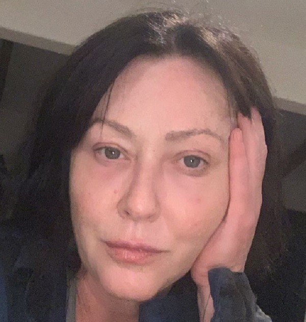 A foto compartilhada pela atriz Shannen Doherty em seu post lamentando o excesso de botox e procedimentos estéticos em Hollywood (Foto: Instagram)