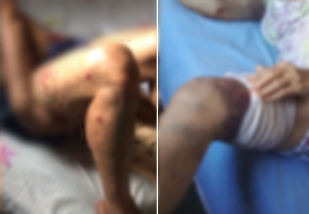 Idosa e vizinho tiveram ferimentos após ataque de pitbulls em Itaporanga (SP) — Foto: Arquivo pessoal