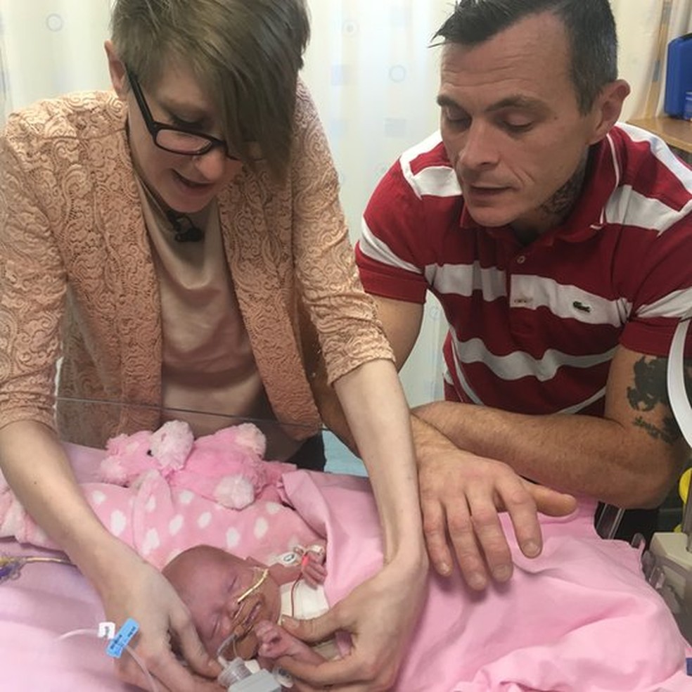 Mesmo aconselhado a fazer um aborto, casal decidiu seguir em frente (Foto: BBC)