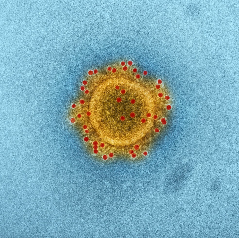Produced by the National Institute of Allergy and Infectious Diseases (NIAID), this highly magnified, digitally colorized transmission electron microscopic (TEM) image highlights the particle envelope of a single, spherical shaped, Middle East respiratory syndrome coronavirus (MERS-CoV) virion, through the process of immunolabeling, the envelope proteins, using rabbit HCoV-EMC/2012 primary antibody, and goat anti-rabbit 10nm gold particles. &mdash; Foto: CDC