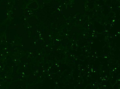 Células em apoptose (verde) no tecido pulmonar de camundongos DBA/2 que morreram de síndrome respiratória aguda associada à malária (Foto: Sabrina Epiphanio/USP)