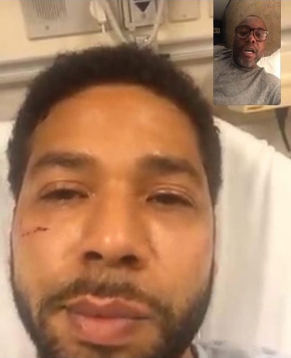 O ator Jussie Smollett com o rosto inchado e ferido no leito do hospital de Chicago em que esteve internado após ser agredido, em conversa por câmera compartilhada pelo produtor de Empire, Lee Daniels (Foto: Instagram)