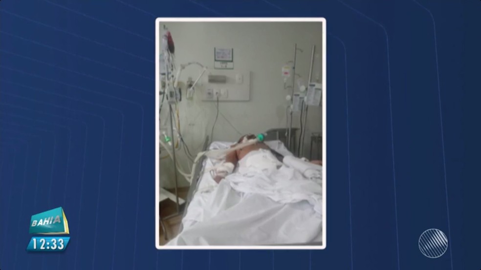 Paciente está internado em estado grave em Feira de Santana (Foto: Reprodução/TV Bahia)