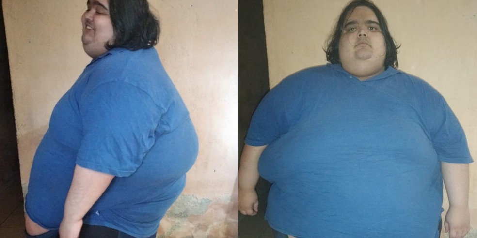 Homem passa dos 300 kg e tenta cirurgia pelo SUS há quatro anos em SP