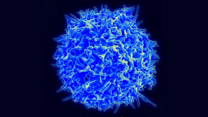 coronavirus_linfocitos.jpg?profile=RESIZE_710x