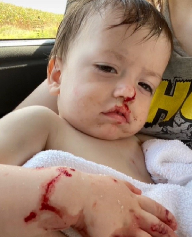 Criança se machuca após box explodir  (Foto: Reprodução Tik Tok )