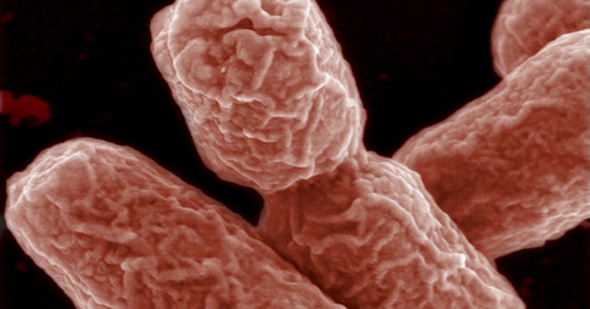 G1 – Die deutsche Öffentlichkeit hat möglicherweise eine Erklärung für die Schwere von „E. coli“ gefunden
