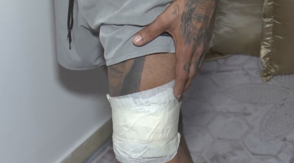 Influenciador vítima de sequestro recebeu golpe de faca na perna — Foto: TV Subaé