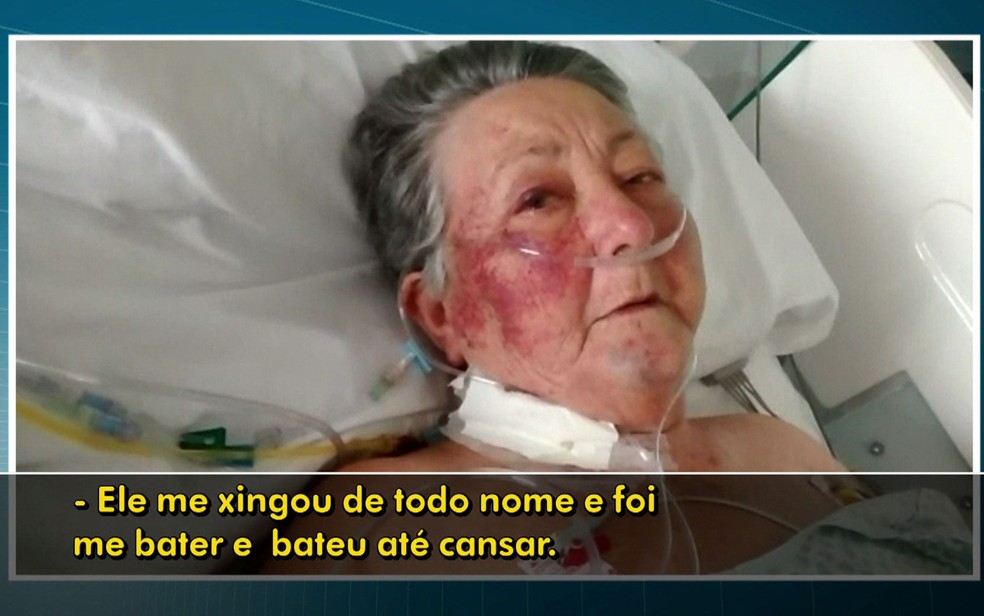 Paciente relata ter sido agredida por enfermeiro do Hospital do Servidor Público Municipal (Foto: TV Globo/Reprodução)