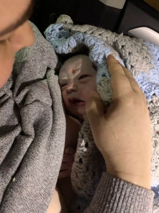 O bebê assim  que nasceu (Foto: Luke Rawlings (arquivo pessoal))