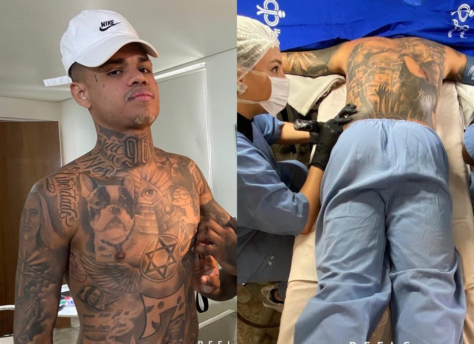 MC Cabelinho toma anestasia geral para fazer tatuagem
