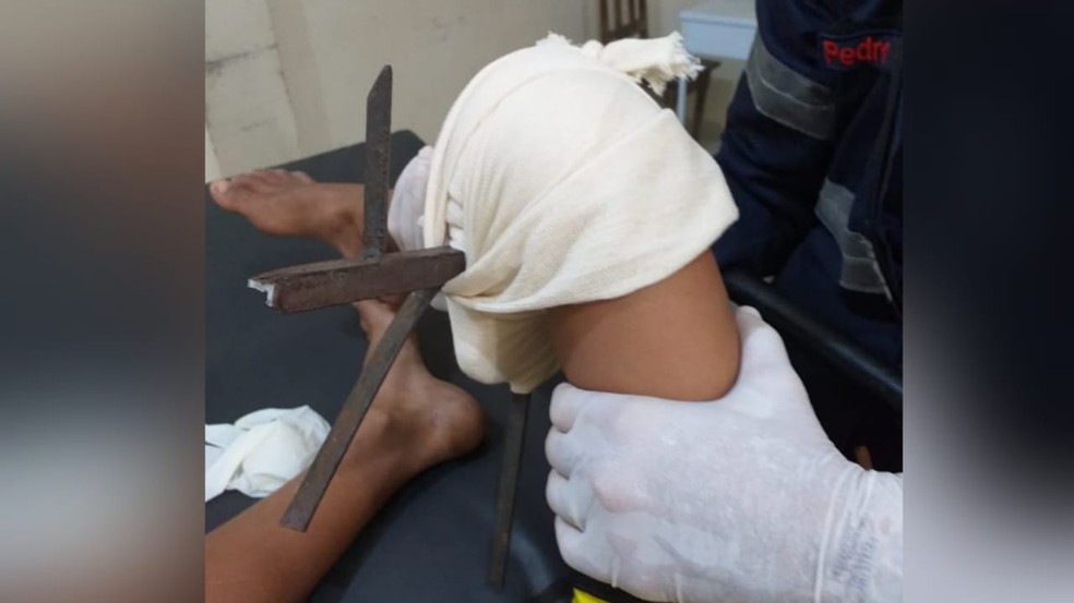 Menino De 8 Anos Tem Perna Perfurada Por Grade De Ferro Durante Brincadeira No Bairro Uruara Santarem E Regiao G1