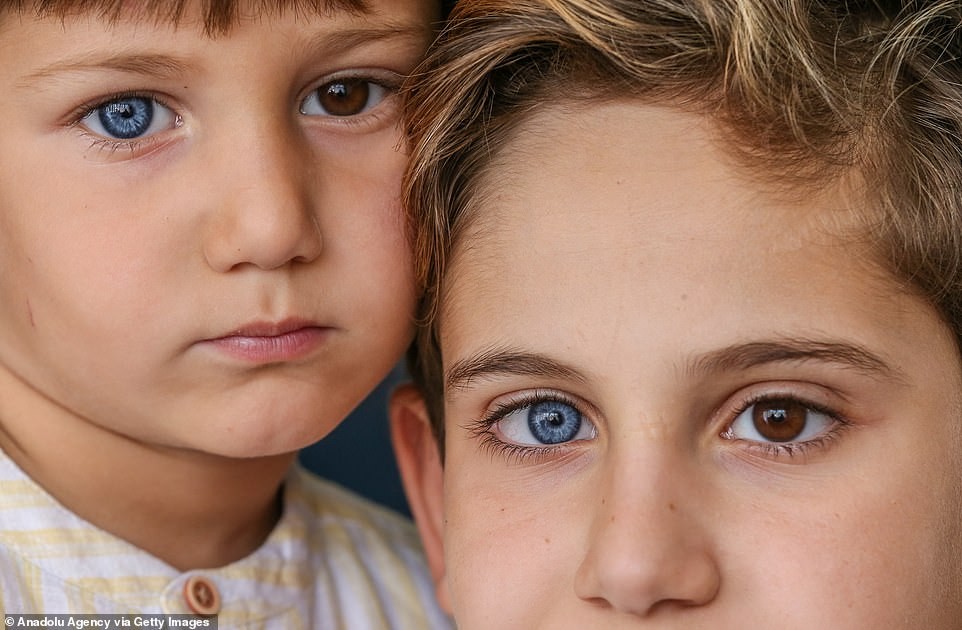 Irmãos com olhos de cores diferentes (Foto: Reprodução)